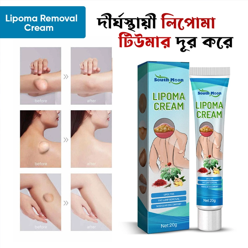 south moon lipoma treatment ointment